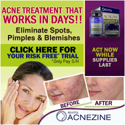 ACNEZINE