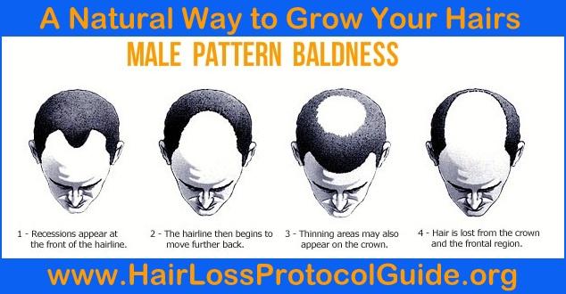 hair loss protocol