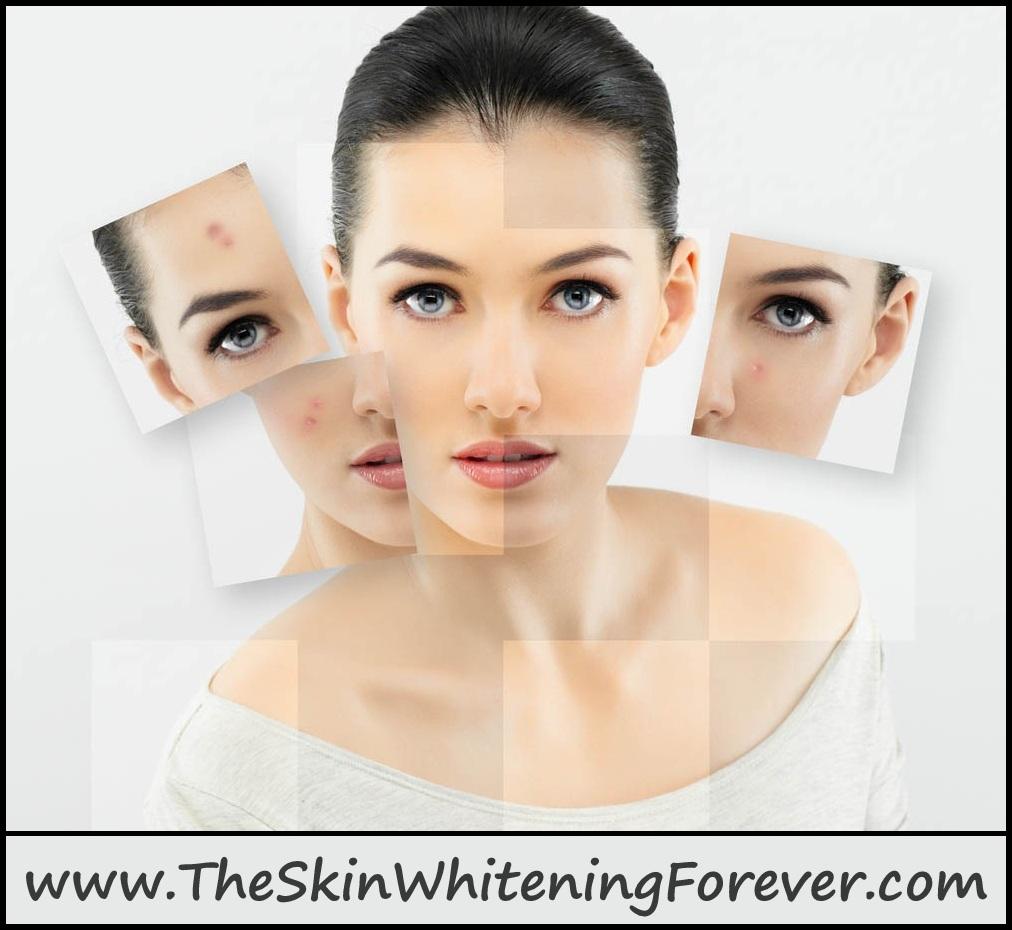 skin whitening forever